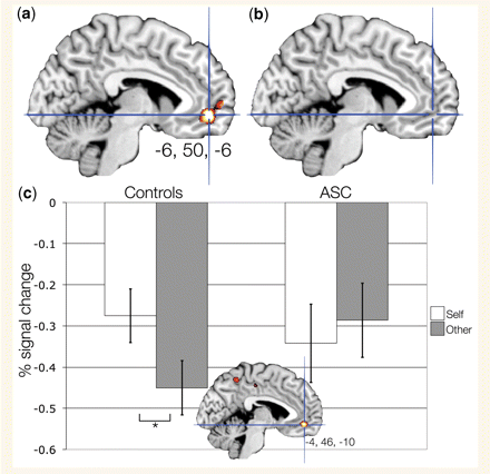 Activation in ventromedial prefrontal cortex (vMPFC) for self-compared with other-judgements (Self > Other). This figure displays activation for the Self > Other contrast within (a) controls, (b) ASC (both displayed at P < 0.05, FDR corrected). Panel (c) shows the group difference in activation for Controls > ASC during Self > Other (MNI x = −4, y = 46, z = −10; thresholded at P < 0.005, uncorrected for display purposes). The bar graph depicts the group difference in activation (controls, left; ASC, right). Error bars indicate ±1 SEM. *P < 0.0005. Note that percent signal change values cannot be assumed to represent equivalent values between-groups, because groups may differ in their underlying physiological baseline level of activity.