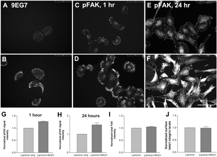 Confirmation of integrin activation by Mn2+. RPE cells plated on laminin (1 µg/ml) in the absence (A) and presence (B) of Mn2+. 9EG7 binding to β1 integrin is increased following Mn2+ treatment. Immunostaining for phosphorylated focal adhesion kinase (pFAK) in RPE cells in the absence (C and E) and presence (D and F) of Mn2+ after 1 h and 24 h. (G and H) Quantification of phosphofocal adhesion kinase levels in RPE cells after Mn2+ treatment. All values normalized to the levels in the absence of Mn2+. No difference in total focal adhesion kinase levels (I) and surface β1 integrin levels (J) were observed following Mn2+ treatment. n = 3. Scale bar = 75 µm.