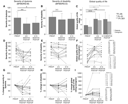 Bar charts (A–C) and line plots (D–I) of outcomes for BFMDRS-M (A, D and G), BFMDRS-D (B, E and H) and global quality of life ratings (C, F and I). Means ± 2 SEM are shown in the bar charts. The line plots show individual values per patient plotted for each time point, the middle panel showing original data, the lower panel depicting percentage change at 2–6 and 9–15 months with preoperative values set to 100% to make improvements and deteriorations easier to distinguish. Significance levels are given on the right. Parentheses signify that the result is not significant any longer after Bonferroni correction.