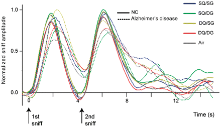 Plots illustrate the two-sniff respiratory profiles for control (NC) and Alzheimer’s disease groups, averaged across each condition. Waveforms were time-locked to the onset of the first sniff and normalized to the maximal amplitude within each subject.