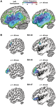 Left inferior frontal cortex and syntax: function, structure and ...