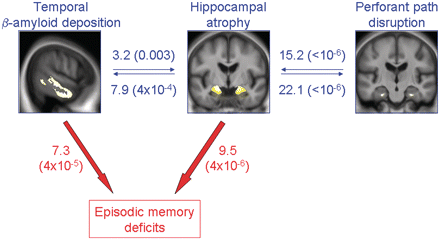 Illustration of the relationships between hippocampal atrophy, perforant path disruption and temporal PiB (blue), and between these three variables and episodic memory deficits (red) in the whole non-demented sample (n = 136). Values indicate ΔR2 (corresponding P-value), i.e. the added value of the variable to the model in percent (Table 2).