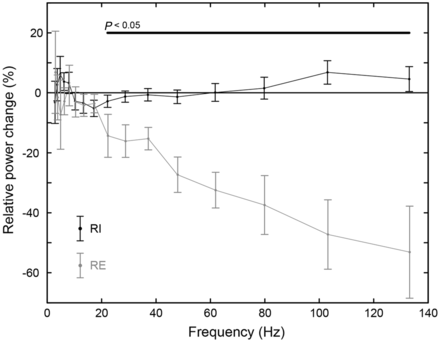 Power changes in auditory cortex at group level. Each hemisphere in each patient was treated as an individual subject. For each hemisphere, power was taken at the closest dipole to the posterior edge of the middle of Heschl’s gyrus. Relative power change was calculated, for each frequency, as 100(Phigh − Plow)/(Phigh + Plow). Points indicate the group mean and error bars indicate the standard error of the mean. The horizontal black bar denotes differences between groups significant at P < 0.05 uncorrected. RE = residual excitation; RI = residual inhibition.