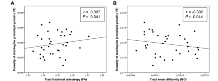 Correlations between intensity of staining for proteolipid protein in non-lesional tract white matter and tractography-derived diffusion-weighted MRI metrics, excluding tract-lesion overlap. Correlations (Pearson’s partial correlation coefficient corrected for post-mortem interval and age) between (A) tract fractional anisotropy and tract myelin proteolipid protein stain intensity and (B) tract mean diffusivity and tract myelin proteolipid protein stain intensity. T = light transmittance.