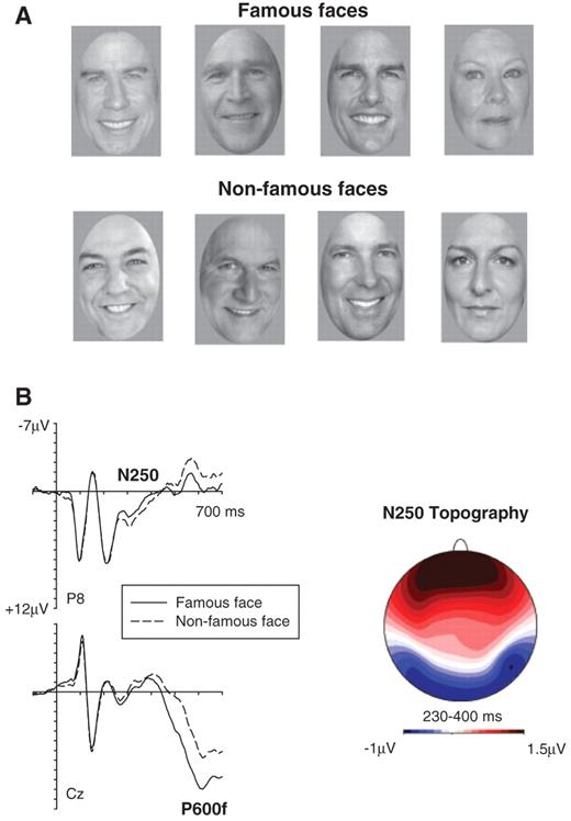 (A) Examples of famous faces and non-famous faces used in the present experiment and in a corresponding study with non-impaired participants (Gosling and Eimer, 2011). Matching famous and non-famous faces are shown in corresponding positions. (B) Grand-averaged event-related potentials measured in the Gosling and Eimer (2011) experiment to famous faces classified as known/familiar (solid lines) and non-famous faces classified as unfamiliar/unknown (dashed lines) in the 700 ms interval after stimulus onset, showing the N250 component at right occipito-temporal electrode P8, and the P600f at midline electrode Cz. The topographic map (right) shows difference amplitudes obtained during the N250 time interval (230–400 ms post-stimulus) by subtracting event-related potential mean amplitudes in response to non-famous faces from mean amplitudes to famous faces. Enhanced negative amplitudes for famous faces are shown in blue, an enhanced positivity in red. The map was constructed by spherical spline interpolation (Perrin et al., 1989).