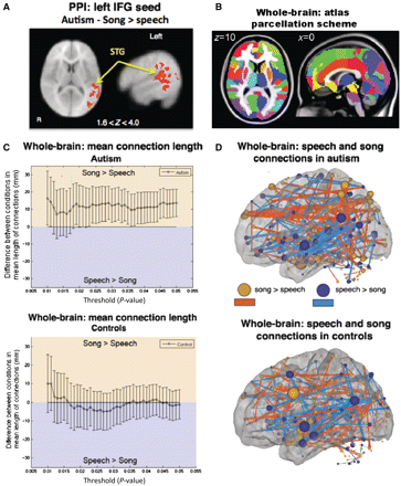 Functional connectivity analyses. (A) Psychophysiological interaction (PPI) analysis in autistic children revealed significant song > speech increases in functional connectivity between left inferior frontal gyrus (IFG) (seed) and clusters spanning superior temporal gyrus (STG) and angular gyrus. Results are shown at Z > 1.6 (P < 0.05) and cluster corrected at P < 0.05. (B) Regions of interest used to parcellate regions for large-scale whole-brain analysis. (C) Large-scale whole-brain analysis showed that in autism (top), connections that are stronger for song relative to speech are longer on average than connections stronger for speech relative to song (plotted with 95% CI). In controls (bottom), connections stronger for speech did not differ in length to connections stronger for song. (D) Anatomical representation of functional connections (lines) between regions (spheres) stronger in song relative to speech (red, P < 0.05 uncorrected) and speech relative to song (blue, P < 0.05 uncorrected) in autistic (top) and control (bottom) subjects (left hemisphere shown). Size of each sphere represents the sum of the lengths of all its connections. For display purposes, the thickness of connections was made proportional to their lengths.