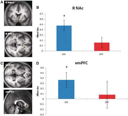 Brain activity correlating with the value of the chosen cue during performance phase. (A) Brain activity in right nucleus accumbens (R NAc) correlated with the value of the chosen cue. Analysis performed over all correct trials (both ON and OFF) in a context where novel parings are presented. (B) A differential analysis between drug states reveals this correlation was selective to the ON state. (C) Brain activity in ventromedial prefrontal cortex (vmPFC) also correlated with the value of the chosen cue. Whole brain analysis performed over all correct trials (both ON and OFF). (D) Similar to activity in nucleus accumbens, the correlation between blood oxygen level-dependent values in ventromedial prefrontal cortex and the value of the chosen cue was only evident in ON but not in OFF state. The error bars represent SEM. Thresholds in statistical parametric map images set to P < 0.005 uncorrected.