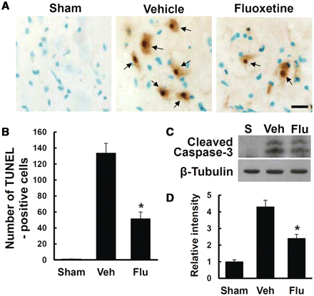 Fluoxetine inhibits caspase 3 activation and apoptotic cell death after spinal cord injury. After spinal cord injury, mice were treated with fluoxetine and spinal tissues and extracts were prepared for TUNEL staining and western blot. (A) Representative images of TUNEL staining at 1 day after spinal cord injury. Scale bar = 20 μm. (B) Quantitative analysis of TUNEL-positive cells (n = 5/group). (C) Western blots of cleaved caspase 3 at 4 h after spinal cord injury. (D) Quantitative analyses of western blots (n = 3/group). Data represent means ± SD. *P < 0.05 versus vehicle controls.