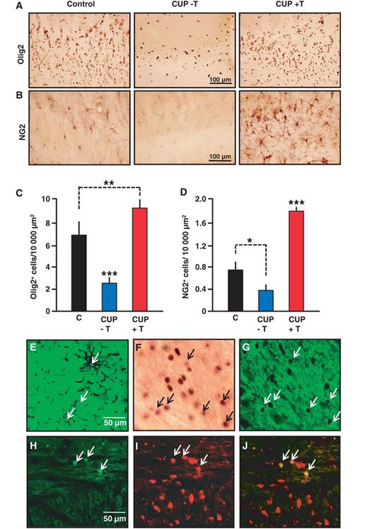 Testosterone treatment significantly increased the number of Olig2+ cells and NG2+ oligodendrocyte precursor cells in the chronically demyelinated corpus callosum. Following cuprizone-induced chronic demyelination, castrated male mice were treated for 6 weeks with empty (−T) or testosterone-filled (+T) subcutaneous Silastic® implants. (A and C) Following the feeding of cuprizone (CUP), the density of Olig2+ cells was markedly decreased within the corpus callosum, and testosterone (T) treatment stimulated their recruitment [group differences F(2, 20) = 34.3, P ≤ 0.001] (n = 6–9 per group). (B and D) Testosterone treatment also caused a 5-fold increase in the number of NG2+ oligodendrocyte precursor cells [group differences F(2, 9) = 32.4, P ≤ 0.001] (n = 4 per group). Values presented in C and D correspond to means ± SEM and were analysed by one-way ANOVA followed by Newman-Keuls post hoc tests. Significance: ***P ≤ 0.001 when compared with controls or testosterone-treated mice (C), or when compared with controls or mice receiving an empty implant (D). **P ≤ 0.01 and *P ≤ 0.05 as indicated. (E–J) The identification of cells induced by testosterone within the cuprizone-demyelinated corpus callosum. (E) Cells double-labelled for Olig2 (yellow-green stained nuclei) and NG2 (black cell processes). (F) Peroxidase immunostaining of Olig2+ nuclei. (G) Double-labeling of the peroxidase immunostained Olig2+ nuclei (black) and CA II+ oligodendrocytes (green) is indicated by arrows. (H) Immunodetection of BrdU+ nuclei of dividing cells. (I) Immunodetection of CA II+ oligodendroglial cells. (J) Co-localization of BrdU and CA II (arrows), visualized by merging H and I.