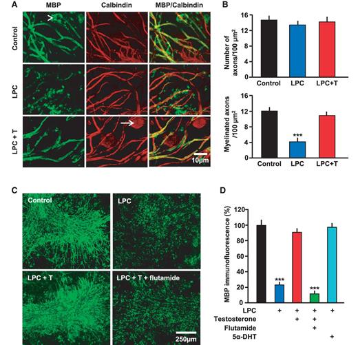 Testosterone promotes the remyelination of cerebellar slice cultures after lysophosphatidyl choline (LPC)-induced demyelination. (A and B) Effect of testosterone (T) and lysophosphatidyl choline treatment on the number of myelinated axons. (A) Antibodies against MBP and calbindin protein were used for the immunostaining of myelin (green) and axons (red). Most axons surrounded by myelin sheaths in control slices were remyelinated after 4 days of treatment with testosterone following lysophosphatidyl choline–induced demyelination. The arrowhead indicates a myelinating oligodendrocyte and the arrow denotes a Purkinje cell. Images were analysed using confocal microscopy. (B) While most axonal myelin was lost, the number of axons was not significantly affected by lysophosphatidyl choline treatment [group differences F(2, 13) = 0.86, P > 0.4], but testosterone restored the number of myelinated axons to normal level [group differences F(2, 12) = 45.0, P ≤ 0.001] (n = 5–6 per group). Values represent means ± SEM and were analysed by one-way ANOVA followed by Newman-Keuls post hoc tests. Significance: ***P ≤ 0.001 when compared with sections treated with vehicle (controls) or testosterone (10 µM) after lysophosphatidyl choline. (C and D) The remyelinating effect of testosterone can be blocked by the selective androgen receptor antagonist flutamide and mimicked by its non-aromatizable metabolite 5α-DHT. (C) Representative immunofluorescence of MBP+ myelin in control slices, after lysophosphatidyl choline–induced demyelination followed by 4 days of vehicle, testosterone or testosterone+flutamide treatment. (D) The corresponding quantification of myelin basic protein immunofluorescence in the cerebellar slices [group differences F(4, 68) = 39.7, P ≤ 0.001] (n = 9–20 per group). Values represent means ± SEM (% of control) and were analysed by one-way ANOVA followed by Newman-Keuls post hoc tests. Significance: ***P ≤ 0.001 when compared with controls or sections treated with testosterone alone or 5α-DHT.