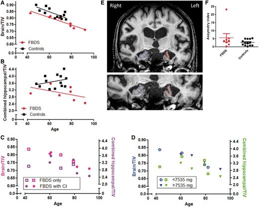 Volumetric hippocampal and whole brain imaging in patients with faciobrachial dystonic seizures. Correlation between age and brain (A) or combined hippocampal volume (×1000) (B) as a ratio of total intracranial volume (TIV) for controls (black) and cases with faciobrachial dystonic seizures (FBDS, red). (C) Total intracranial volume-normalized brain and combined hippocampal volumes in cases with (filled circles) and without (open squares) cognitive impairment (CI) and (D) in cases administered greater than (filled triangles) or less than (open circles) the median total corticosteroid dose (7535 mg). Two T1-weighted coronal MRIs through the left (red) and right (blue) hippocampi (E) of the case with marked hippocampal asymmetry (F).