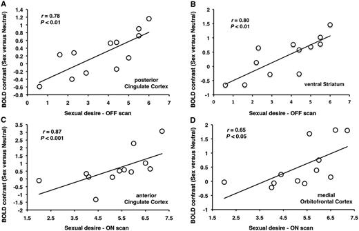 In patients with Parkinson’s disease with hypersexuality, sexual desire post-exposure to sexual imagery correlates with increases in activation in (A) posterior cingulate cortex and (B) ventral striatum in the OFF medication state and with increases in activation in (C) anterior cingulate cortex and (B) and medial orbitofrontal cortex during the ON medication state.