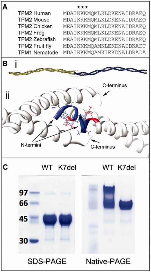 K7del-βTm modelling and polymerization studies. (A) Alignment of the N-terminus of sarcomeric tropomyosin sequences in multiple species demonstrates the high degree of conservation for this region of tropomyosin, including full conservation of K5, K6 and K7. (Bi) Adjacent tropomyosin dimers bind in a head-to-tail manner to form a long polymer. (Bii) Enlargement of box in Bi. Model of the short four-helix bundle at the tropomyosin junction that encompasses the first lysine residue (K5; red) within the N-terminal region of β-tropomyosin (blue). If K7del-βTm molecules dimerize appropriately along central and C-terminal regions, the deletion of an N-terminal lysine (arbitrarily named K7) will manifest as an absence of K5 and misalignment of the first four N-terminal residues (blue). (C) Recombinant WT-βTm runs as both a tropomyosin dimer and higher molecular weight species in native-PAGE gels which likely represent polymerized dimers. In comparison, K7del-βTm appears as a dimer only, suggesting an impaired ability to polymerize.