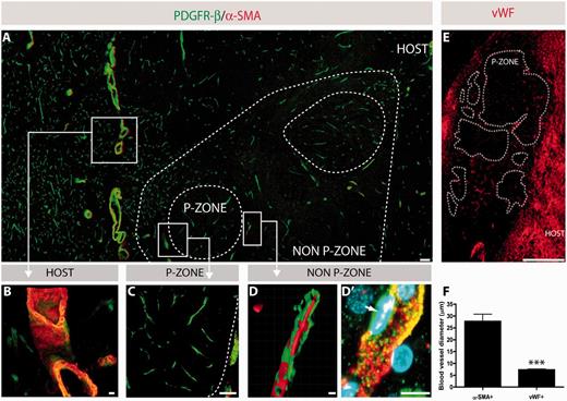 Discrepancies in vascularization between grafts and host tissue. Double immunofluorescence for type A pericytes, labelled with PDGFR-β in green, and type B pericytes, labelled with PDGFR-β and α-SMA-positive blood vessels in red (co-labelled in yellow) further revealed that large calibre blood vessels are not present within graft p-zones (dashed lines) (A and C), but are detectable in the graft non-p-zones (A, D and D’) as well as in the host (A and B). Pericytes were observed in the p-zones associated with capillaries, but not with large calibre α-SMA blood vessels (C). Various examples of blood vessels and blood-associated elements (e.g. pericytes) at higher magnification (B–D’). Larger calibre blood vessels, as observed in the host, stained positively for both PDGFR-β and α-SMA (B). Photomicrograph illustrating the exclusive presence of capillaries within a graft p-zone (C). 3D reconstruction, as performed by confocal microscopy, depicting the presence of pericytes (green) onto a blood vessel (red) (D). Higher magnification of a triple staining (PDGFR-β in green, α-SMA in red and 4′,6-diamidino-2-phenylindole in blue) illustrating pericytes and their relationship to a blood vessel, as visualized in a non-p-zone of the grafted tissue (D’). Immunofluorescence for the blood glycoprotein vWF revealed a significantly greater number of capillaries in the host parenchyma than in the grafted tissue (E, also see Fig. 2C and D). To further confirm the presence of distinct blood vessel populations, diameters were measured for 40 sampled vWF-positive and α-SMA-positive vessels, which further revealed a significant difference (F). The values are expressed as a mean ± SEM (Student’s t-test; ***P < 0.001). Scale bars: A = 100 µm; B = 10 µm; C = 100 µm, D, D’ = 10 µm; E = 1 mm.