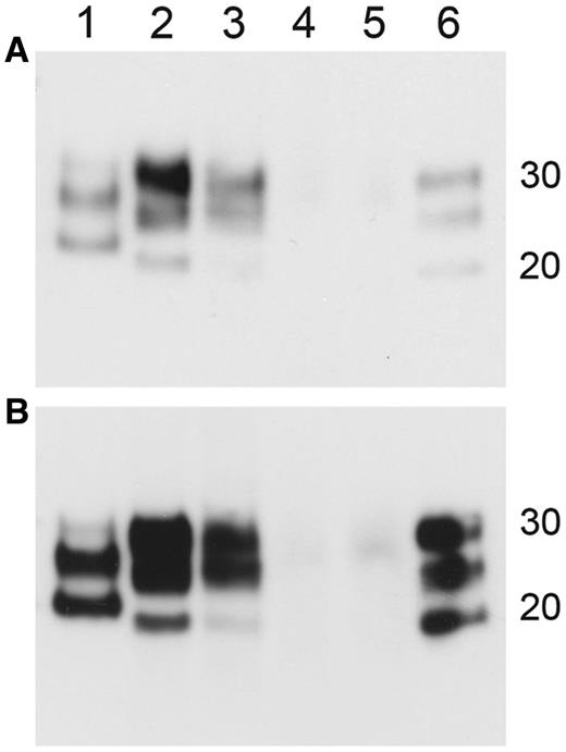 Western blot data from HuMM mice inoculated with brain and spleen derived variant Creutzfeldt–Jakob disease inocula. Duplicate blots (A and B) exposed for different lengths of time to visualize band mobility. Lanes: (1) sporadic Creutzfeldt–Jakob disease type 1; (2) blood donor brain tissue inoculum; (3) blood donor spleen tissue inoculum; (4) blood recipient brain tissue inoculum; (5) blood recipient spleen tissue inoculum; (6) variant Creutzfeldt–Jakob disease type 2B. Molecular weight marker position shown at 20 kDa and 30 kDa. Antibody = 6H4.