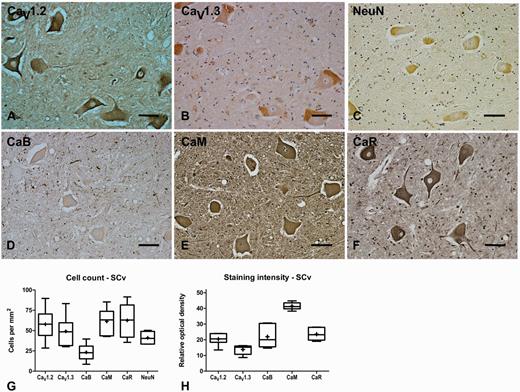 Representative immunohistochemistry staining and quantification in the ventral horn of normal spinal cord. Representative immunohistochemistry of CaV1.2 (A), CaV1.3 (B), neuronal nuclei (NeuN, C), calbindin (CaB, D), calmodulin (CaM, E) and calreticulin (CaR, F) in normal ventral horn of the lumbar spinal cord (SCv) showing labelling of α-motor neurons in this region. Box and whisker plots of stereological cell counts (G) and densitometry of relative staining intensity (H) in the ventral horn of the lumbar spinal cord. Box = 25th and 75th percentiles; line = median; + = mean; whiskers = 5th and 95th percentiles. Scale bar = 100 µm.