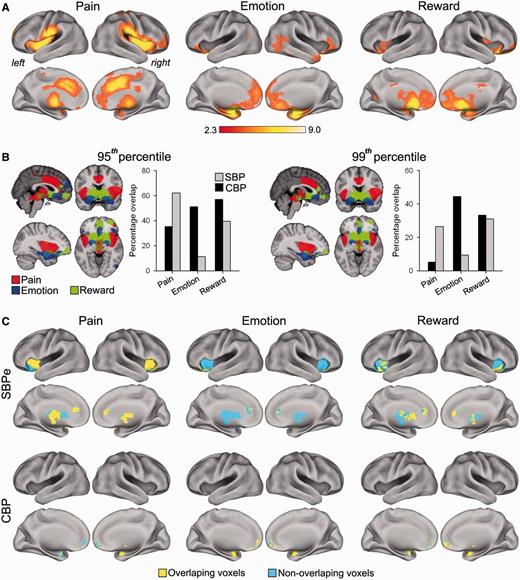 Early SBP (SBPe) and CBP activation maps correspond to distinct meta-analytic circuits. (A) Brain meta-analytic maps for the terms: pain, emotion and reward, from Neurosynth (Yarkoni et al., 2011). (B) Brain images represent masks derived from maps above at different thresholds (top five and one percentile voxels) for pain (red), reward (green) and emotion (blue) meta-analytic maps. Bar graphs represent the % overlap for CBP (black) and early SBP (grey) with the three meta-analytic maps at the 95th and 99th percentile thresholds. Overall SBP activity is more similar to the pain term related mask, whereas CBP activity is similar to emotion term related mask. Activity in both groups engage parts of the reward mask. (C) Brain images show the overlapping (yellow) and non-overlapping (blue) voxels for early SBP (top row) and CBP (bottom row) with the 95th percentile thresholded meta-analytical masks. Early SBP overlaps with pain mainly in bilateral insula, thalamus and anterior cingulate cortex (ACC), whereas CBP overlaps with emotion in bilateral amygdala and medial prefrontal cortex (mPFC).