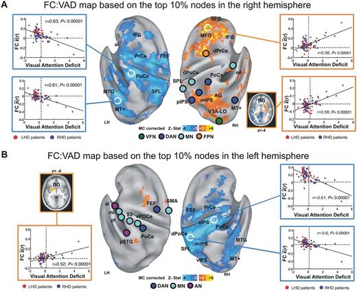 Behaviourally-relevant functional connectivity. Voxel-wise functional connectivity (FC):VAD maps based on the top 10% of nodes showing the highest loading with the first principal component from the PCA of functional connectivity:VAD maps. (A) Functional connectivity:VAD map derived from the top 10% right hemisphere nodes (n = 9) (illustrated in Fig. 3B). Nodes are displayed as circles whose colour indicates network identity, consistent with Fig. 2. Functional connectivity:VAD correlation maps are thresholded at P < 0.05 (multiple comparisons corrected, cluster size 17 voxels). Blue-cyan hues indicate negative functional connectivity:VAD correlation (low functional connectivity = high VAD); orange-yellow hues indicate positive functional connectivity:VAD correlation (high functional connectivity = high VAD). Inset scatter plots show the relation between VAD and mean functional connectivity between the nine nodes and the region demarcated by white circles. As in Fig. 1, vertical dashed lines indicate the boundary between patients with (N+) and without (N−) patients. Blue circles = RHD patients; red circles = LHD patients. Inset in lower right portion of A shows functional connectivity:VAD correlations for regions in right and left putamen (BG). Region labels correspond to Supplementary Table 1. (B) Functional connectivity:VAD map derived from the top 10% left hemisphere nodes (n = 9) (illustrated in Fig. 3D), conventions as in A. VFN = visual foveal network; DAN = dorsal attention network; MN = motor network; VAN = ventral attention network; FPN = fronto-parietal network; FEF = frontal eye field; SMA = supplemental motor area; aI = anterior insula; pI = posterior insula; mI = middle insula; pSTG = posterior superior temporal gyrus; vPoCe = ventral post-central gyrus; mIPS = middle intraparietal sulcus; SPL = superior parietal lobule; pIPS = posterior intraparietal sulcus; dPrCe = dorsal precentral gyrus; PoCe = post-central gyrus; MT+ = middle temporal area; V3A-LO = visual area 3A-lateral occipital complex.