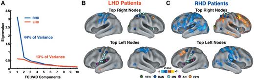Behaviourally-relevant functional connectivity in right (RHD) and left (LHD) hemisphere damaged patients. (A) Scree plot derived from the spatial principal component analysis of 169 functional connectivity (FC):VAD correlational maps in right (RHD) and left (LHD) hemisphere damaged patients (n = 42 in both groups). Functional connectivity:VAD associations were considerably stronger in right as opposed to left hemisphere damaged patients Blue: RHD; Red: LHD. (B) Voxel-wise functional connectivity:VAD map from top 10% right nodes (n = 9) (top) and from top 10% left nodes (n = 9) (bottom) in the LHD group (n = 42). (C) Same map as in B generated in the RHD group (n = 42). The top 10% nodes were derived from the whole-sample analysis (Fig. 3B and D). (B and C) The nodes and colour scale as in Fig. 4. VFN = visual foveal network; DAN = dorsal attention network; MN = motor network; FPN = fronto-parietal network; AN = auditory network.