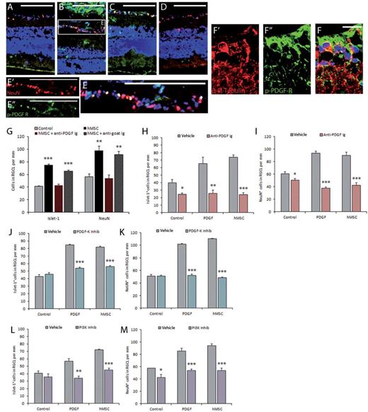 Role of PDGF signalling in retinal ganglion cell neuroprotection by MSCs. Retinal explants were cultured alone (A); with human MSCs (B, E and F); with PDGF-AA + PDGF-AB (50 ng/ml) added to the culture media (C); or with PDGF-AA + PDGF-AB (50 ng/ml) plus anti-PDGF IgG (35 µg/ml) added to the culture media (D). Retinal ganglion cell (RGC) layer neurons were visualized with NeuN (A–E) or β-III-tubulin (F) immunofluorescence (red) and PDGF signalling was detected with phospho-PDGF receptor immunofluorescence (green). Nuclei were visualized with DAPI (blue). Higher magnification image of the RGC layer in B is depicted as individual channels in E’ and E’’ and merged in E. Scale bars: A–E = 200 µm; F = 25 µm. Retinal explants were cultured alone, or with the addition of PDGF-AA + PDGF-AB (50 ng/ml) to the culture media, or with human MSC co-culture for 7 days. Half of the explants from each group were additionally treated with non-specific anti-goat IgG (35 µg/ml, G); anti-PDGF IgG (35 µg/ml, G–I); small molecular inhibitor of PDGF receptor kinase, AG1296 (45 µM, J–K); or small molecule inhibitor of PI3 kinase, LY294002 (75 µM, L–M). *P < 0.05; **P < 0.01; ***P < 0.001. Error bars represent standard error of the mean. Control indicates without cell co-culture or addition of PDGF to growth media.