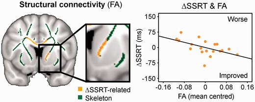Citalopram’s effect on response inhibition was also related to the strength of structural connectivity (fractional anisotropy, FA) between the frontal cortex and striatum, showing a negative correlation of the drug-induced SSRT change (ΔSSRT) with fractional anisotropy of the skeleton voxels in the right internal capsule (mean centred). Thresholded at P < 0.05 TFCE-corrected.
