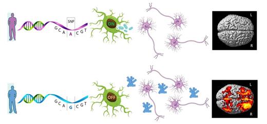 In a genome-wide study, Ramanan et al. discover an association between the microglial activation gene IL1RAP and higher rates of amyloid plaque accumulation as measured by PET in prodromal Alzheimer’s disease. Activated microglia may be crucial in amyloid clearance, and targeting the interleukin-1/IL1RAP pathway may be a potential therapeutic approach.