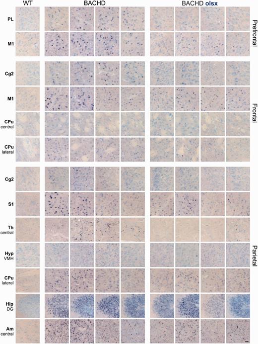 Effects of olesoxime on mutant huntingtin aggregates and nuclear accumulation in different brain regions. Aggregation and nuclear accumulation of mutant HTT were investigated in coronal brain sections from 13-month-old rats, stained with S830 N-terminal mutant HTT antibody. Images were taken from prefrontal, frontal and parietal brain areas. Columns display series of images from individual rats [wild-type (WT) n = 1, BACHD, n = 4]. Distinct punctae represent mutant HTT cytoplasmic aggregates and large circular staining represents mutant HTT nuclear accumulation. Black–purple staining = S830 huntingtin signal; blue staining = thionine nuclear signal. Magnification: ×400; Scale bar = 10 µM. Olsx = olesoxime; PL = prelimbic cortex; M1 = motor cortex 1; Cg = cingulate cortex; CPu = caudate putamen; S = somatosensory cortex; Th = thalamus; Hyp = hypothalamus; VMH = ventro-medial hypothalamus; Hip = hippocampus; DG = dentate gyrus; Am = amygdala.