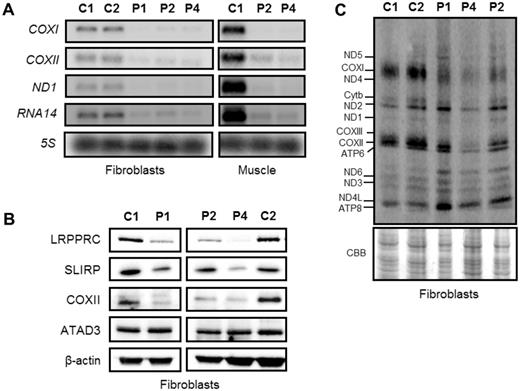 The effect of LRPPRC mutations on the steady-state levels of mitochondrial mRNAs and mitochondrial translation products. (A) Mitochondrial mRNAs in fibroblasts and skeletal muscle from LRPPRC patients were significantly reduced. Total RNA was isolated from control and patient fibroblasts and muscle, and the levels of mitochondrial mRNAs were analysed by northern blotting. Probes against specific mitochondrial open reading frames, COXI, COXII, ND1 and RNA14 were used and a probe for the 5S cytosolic rRNA was used as loading control. (B) Reduction in SLIRP steady-state protein levels in the LRPPRC patient fibroblasts were confirmed by western blot analysis. β-Actin was used as loading control. (C) Analysis of mitochondrial-encoded polypeptides by 35S methionine/cysteine pulse labelling revealed a marked decrease in mitochondrial translation in the compound heterozygous patient cells (Patient 4) compared to age-matched controls (C1 and C2). Coomassie Brilliant Blue (CBB) staining was used to check for equal loading of the samples.