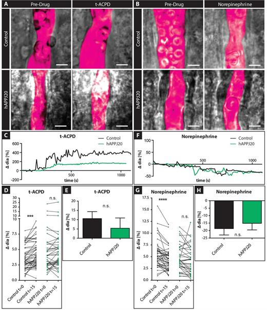 Pharmacological stimulation of vasoactive signalling in hAPPJ20 mice. (A) DIC images of vessels in acute slices of control and hAPPJ20 mice before and after application of 100 µM trans-ACPD (t-ACPD) or (B) 10 µM norepinephrine (NE) in 14-month-old animals. The vessel lumen was outlined digitally (magenta pseudocolour). Scale bar = 5 μm. (C) Example traces of control (black) or hAPPJ20 (green) vessels during bath application of t-ACPD show dilation of the vessels in response to t-ACPD. (D) To better illustrate the response of individual vessels, vessel diameters were plotted before and 15 min after t-ACPD bath-application. Control, n = 49 vessels from seven animals; hAPPJ20, n = 38 vessels from 6 animals; two-way repeated measures ANOVA: genotype × drug interaction, P = 0.10; drug effect, P < 0.0001; on post hoc Bonferroni comparisons: drug effect in controls: ***P < 0.001, drug effect in hAPPJ20 not significant (n.s.). (E) Average change in vessel response after t-ACPD bath application in control and hAPPJ20 mice. Control, 10.56 ± 3.76% change in vessel diameter, n = 45 vessels from seven animals; hAPPJ20, 5.39 ± 5.51% change in vessel diameter, n = 36 vessels from six animals, Mann-Whitney, two-sided, P = 0.3031. (F) Example traces of control (black) or hAPPJ20 (green) vessels show constriction during bath application of norepinephrine. (G) To better illustrate the response of individual vessels, vessel diameters were plotted before and 15 min after norepinephrine bath application. Control, n = 45 vessels from seven animals; hAPPJ20, n = 37 vessels from six animals; two-way repeated measures ANOVA: genotype × drug interaction, P = 0.07; drug effect, P < 0.0001; on post hoc Bonferroni comparisons: drug effect in controls: ****P < 0.0001, drug effect in hAPPJ20 not significant (n.s.). (H) Average change in vessel response after norepinephrine bath application in control and hAPPJ20 mice. Control, − 18.65 ± 4.29% change in vessel diameter, n = 44 vessels from seven animals; hAPPJ20, −15.13 ± 4.43% change in vessel diameter, n = 36 vessels from six animals, two-sided t-test, P = 0.5715.