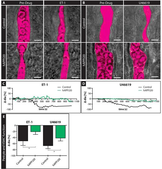 Vascular smooth muscle cell/pericyte function is impaired in acute slices of hAPPJ20 mice. VSMC/pericyte function was assessed by pharmacological stimulation of these cells in acute slices of 15-month-old animals. (A and B) DIC images of vessels before and after bath application of Endothelin-1 (A) and U46619 (B) to acute slices of control and hAPPJ20 mice. The vessel lumen was outlined digitally (magenta pseudocolour). Scale bar = 5 µm. (C and D) Example traces of control (black) or hAPPJ20 (green) vessels during bath application of ET-1 or U46619 show a stronger constriction of control than hAPPJ20 vessels. (E) Quantification of changes in vessel diameter after bath application of vasoconstrictors. hAPPJ20 vessels showed reduced vessel constriction compared to control vessels in response to ET-1 and U46619. ET-1: control, n = 9 vessels from four animals versus hAPPJ20, n = 18 vessels from five animals, unpaired t-test, one-sided, *P = 0.0386. U46619: control, n = 15 vessels from three animals versus hAPPJ20, n = 22 vessels from five animals, one-way Mann-Whitney, one-sided *P = 0.0361.