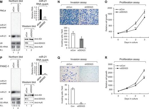 DDX23 promotes invasion and proliferation of patient-derived glioma stem cells (GSCs) and various cancer cell lines via modulating miR-21 biogenesis. (A, D, G, J, M and P) Specific knockdown of DDX23 induced downregulation of miR-21 in patient-derived glioma stem cells X01 (A), CSC2 (D), non-small cell lung cancer A549 (G), prostate cancer DU145 (J), cervical cancer HeLa (M) and pancreatic cancer PANC-1 (P) cell lines. Glioma stem cells X01, CSC2 and A549 were infected with control (shCon) or shDDX23 expressing lentiviral construct (shDDX23). Scrambled (siCon) or DDX23 specific (siDDX23) siRNA was transfected to the other cancer cell lines (DU145, HeLa and PANC-1). The level of endogenous miR-21 was monitored by northern blotting with miR-21-specific 32P 5′-end-labelled oligonucleotide probe. Arrow indicates position of mature miR-21. 5S rRNA was used as the loading control and U6 was used as hybridization control (lower left). The quantification of mature miR-21 is shown in graph (upper right). The experiments were repeated at least three times with similar results. The figures shown in A, D, G, J, M and P are representative. Specific knockdown of DDX23 was confirmed by semi-quantitative RT-PCR (X01 and CSC2) or western blot analysis (A549, DU145, HeLa and PANC-1) (lower right). (B, E, H, K, N and Q) Invasion assay was performed in patient-derived glioma stem cells and various cancer cell lines after specific knockdown of DDX23. Representative photos of invaded cells (upper), quantitative data of invaded cells (lower left), and all error bars in graph represent mean ± SEM (n = 3). *P < 0.05, **P < 0.01 (C, F, I, L, O and R) Proliferation assay was performed in patient-derived glioma stem cells and various cancer cell lines after specific knockdown of DDX23. All error bars in graph represent mean ± SEM (n = 3). *P < 0.05, **P < 0.01.