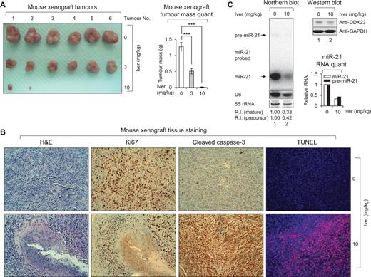 RNA helicase inhibitor ivermectin abrogates mouse xenograft growth in vivo. (A) Subcutaneous tumours isolated from ivermectin or its control vehicle-treated mice. Mice were subcutaneously injected with 5 × 106 U87MG glioma cells. These mice were administered with 3 mg/kg of ivermectin (3; middle line), 10 mg/kg of ivermectin (10; bottom line) or its control vehicle (0; upper line) as an intratumoural route. After 6 weeks, mice were sacrificed and then subcutaneous tumours were isolated. Total number of tumours for each group was six. Four tumours from 10 mg/kg of the ivermectin treated group were not detectable. Right: Graph represents mean tumour mass of each group. ***P < 0.001. (B) Histological analysis of subcutaneous tumour tissues isolated from 10 mg/kg of ivermectin (10; bottom panel) and its control vehicle (0; upper panel) treated mice. Isolated tissues were stained by haematoxylin and eosin (H&E), Ki67, cleaved caspase-3, and TUNEL, respectively. (C) Ivermectin treatment induced downregulation of miR-21 in vivo. Northern blot analysis of subcutaneous tumour tissues isolated from 10 mg/kg of ivermectin (10) and its control vehicle (0) treated mice. Northern blot was performed with miR-21-specific 32P 5′-end-labelled oligonucleotide probe. Arrows indicate positions of precursor (upper) and mature (lower) miR-21. 5S rRNA was used as the loading control and U6 was used as hybridization control (lower left). The quantification of precursor and mature miR-21 are shown in graph (lower right). Protein level of DDX23 and GAPDH (loading control) were confirmed by western blot (upper right). The experiments were repeated at least three times with similar results. The figure shown in C is representative. R.I. = relative intensity.