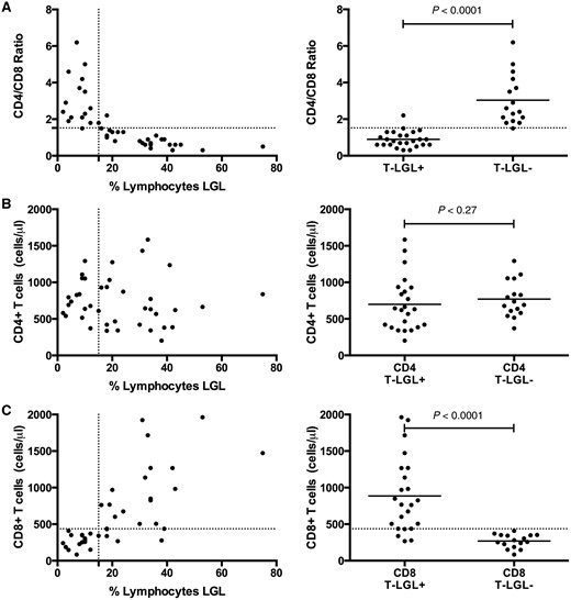 Reduced CD4/CD8 ratios due to expanded CD8 counts in patients with LGL expansions. ( A ) A CD4/CD8 threshold ratio of 1.5 was an excellent classifier for absence (ratio > 1.5) or presence (ratio ≤ 1.5) of LGL expansion (defined by > 15% of lymphocytes being LGLs). The reduction in CD4/CD8 ratio is not due to reduction of ( B ) CD4 count but rather due to expansion of the ( C ) CD8 count.
