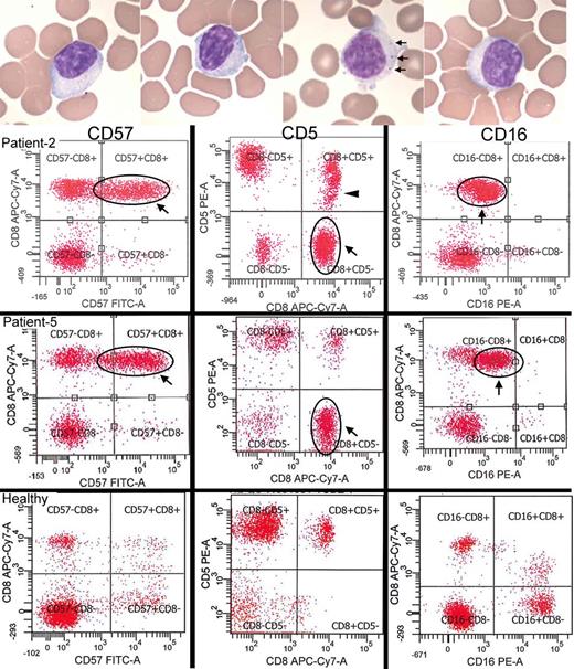 See Hohlfeld and Schulze-Koops (doi: 10.1093/brain/aww053 ) for a scientific commentary on this article.