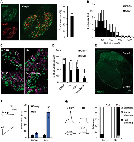 Intrathecal delivery of GluCl-AAV efficiently transduces sensory neurons. Analysis of tissue taken from animals 4 weeks following intrathecal co-delivery of AAV9-GluClα and AAV9-GluClβ. (A, left) L4 DRG immunostained for YFP (green) and NeuN (red). Scale bar = 100 μm. (Right) GluCl+ DRG as a proportion of total neurons. Data represent mean ± SEM from three animals and a total of 912 neurons. (B) Size distribution of GluCl+ neurons. Data pooled from three animals and represent a total of 379 cells. (C) GluCl (green) co-localization with DRG subpopulation markers (magenta). White arrows show double-labelled neurons. Scale bar = 30 µm. (D) Percentage of GluCl+ DRG in the different subpopulations. Data represent results from n = 3 animals and a total of >600 cells/group. (E) Representative lumbar spinal cord immunostained for YFP (n = 4 animals assessed). Scale bar = 100 µm. (F) Membrane conductance of ex vivo GluCl+ neurons taken from GluCl-AAV animals untreated (Naïve) and 24 h following 5 mg/kg i.p. ivermectin (IVM). (Left) Current traces in response to membrane voltage ramp −90 to −40 mV (0.5 mV/ms) of neurons from ivermectin treated animals. (Right) Quantification of membrane conductance. One-way ANOVA followed by post hoc Bonferroni test comparing groups to control (Naive β-only), naive β-only, n = 8; naïve αβ, n = 7; ivermectin β-only, n = 8; ivermectin αβ, n = 10. (G) Firing properties of GluCl-AAV animal derived GluCl+ neurons. (Left) Action potential traces in response to depolarizing current injection of DRG neurons derived from ivermectin-treated animals. (Right) Excitability status as defined by a rheobase value: <3 (excitable), 3–10 (partial silencing) or >10 (full silencing) standard deviations above the mean of control (Naïve β-only, mean = 160.1 ± 160.6 pA). P < 0.001, chi-squared test (χ2 = 32.52 with 6 degrees of freedom); Naive β-only, n = 8; Naïve αβ, n = 7; ivermectin β-only, n = 8; ivermectin αβ, n = 10. All averaged data represent the mean ± SEM. ***P < 0.001.