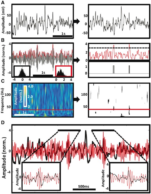 Method for detecting gamma frequency activities. Two detections of gamma frequency activity in frequency band 40–41 Hz are presented in one example of 3000 ms recording epoch from an occipital cortical electrode contact. (A) Raw data epoch (left) was first corrected for shifts in direct current and slow oscillations (<1 Hz) and notch filtered to remove power from line noise (right). (B) The signal was then band-pass filtered in a 1 Hz step from 40 to 41 Hz (left) and the amplitude was normalized using z-score before calculating Hilbert spectral envelope (red trace above the filtered signal) because the amplitude values are normally distributed (lower left black inset histogram) in contrast to the spectral envelope values (lower right red insert histogram). Hence the spectral envelope trace was thresholded at 3 SD (dashed line) determined from the population of amplitude values (right). Two threshold crossings corresponding to two detections are presented in binary format. (C) Coloured spectrogram matrix visualizes the normalized Hilbert amplitude values across all filtered frequency bands from 1 to 150 Hz (left) including the 40–41 Hz example from B (red rectangle). The matrix was transformed into the binary format as in B to identify discrete islands of significant gamma frequency activity above z-score threshold > 3 (right). (D) Two detections at the 40 to 41 Hz band are shown in the enlarged inset plots of the raw data epoch from A (black trace), which is superimposed on 40 to 41 Hz band-pass filtered signal (red trace).