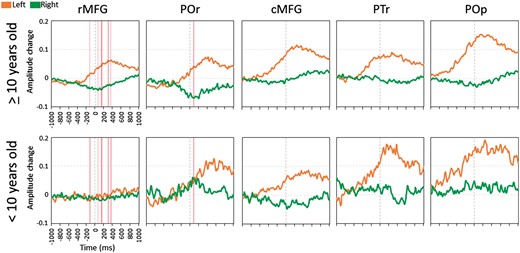 Difference in auditory naming-related high-gamma modulation in the inferior/middle frontal gyri between the older and younger groups. Orange line: mean amplitude change in the left hemisphere. Green line: mean amplitude change in the right hemisphere. ‘+0.1’ indicates 10% amplitude augmentation compared to the baseline during the resting period. Pink vertical bars denote the epochs when left-to-right asymmetry significantly differed between the older and younger groups (Bonferroni corrected P < 0.05). cMFG = caudal middle-frontal gyrus; POr = pars orbitalis of the inferior-frontal gyrus; PTr = pars triangularis of the inferior-frontal gyrus; POp = pars opercularis of the inferior-frontal gyrus; rMFG = rostral middle-frontal gyrus.