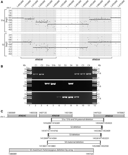 Identification of genomic ATAD3 deletions. (A) A custom CGH array was used to delineate homozygous deletions detected on chromosome 1 p in DNA from Subjects S1a and S2. Shaded boxes indicate the location of the ATAD3C, ATAD3B and ATAD3A genes. Details of deleted regions predicted by SNP and CGH arrays are summarized in Supplementary Table 2. (B) Long-range PCRs were performed on genomic DNA from subjects and controls. Primers OT472 and OT473 (middle panel) flank the ATAD3 deletion breakpoints predicted in Subject S1a by array CGH. Primers OT572 and OT575 (bottom panel) flank the ATAD3 deletion breakpoints predicted in S2 by array CGH. As a control, primers OT570 and OT575 (top panel) were used since primer OT570 is located within the predicted deleted ATAD3B/ATAD3A region. (C) Genomic DNA sequencing of the breakpoint-spanning PCR products determined the ATAD3B/ATAD3A deletion boundaries in each subject, with chromosome 1 coordinates indicated (hg19). Ambiguous regions flanking the deletion boundaries that have identical sequence in ATAD3B and ATAD3A are identified by dark grey boxes. The deletion predicted by high-density SNP array for Subject S5 is indicated, with maximum and minimum deletion boundaries labelled by hatched boxes.