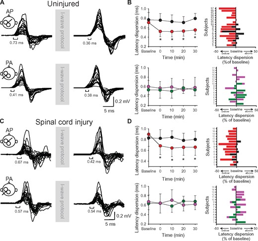MEP onset latency dispersion. Raw MEP traces from the first dorsal interosseous muscle for a representative uninjured (A) and SCI subject (C) tested with the coil in the AP (upper) and PA (lower) orientation before and after the I-wave protocol. Twenty superimposed MEPs are shown in each condition. (B and D) Graphs showing group (n = 17; SCI, n = 15, left) and individual (right) data. The abscissa shows the time at which MEPs were tested (baseline, and 0, 10, 20 and 30 min after stimulation) and the ordinate shows the MEP onset latency dispersion (in ms) before and after the I-wave (upper graphs in B and D) and control (lower graphs in B and D) protocol. MEP onset latency dispersions (expressed as a percentage of baseline) are shown for individual subjects for MEPs tested in the AP (I-wave protocol = red bars, control protocol = black bars) and PA (I-wave protocol = purple bars, control protocol = green bars) orientation in both groups. Error bars indicate SDs. *P < 0.05, comparison between protocols; ¥P < 0.05, comparison with baseline.