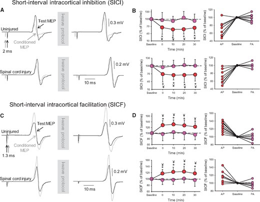 Intracortical inhibition. SICI (A) and SICF (C). Test (black traces) and conditioned (grey traces) MEPs elicited in the first dorsal interosseous muscle of a representative uninjured (upper traces) and SCI (lower traces) subject at an interstimulus interval of 2.0 ms (SICI) and 1.3 ms (SICF) with the coil positioned in the AP orientation before and after the I-wave protocol. For SICI, the conditioning stimulus is given before the test stimulus, and for SICF the conditioning stimulus is given after the test stimulus. Waveforms represent the average of 20 MEPs. Group (left) and individual (right) data are shown in graphs when SICI (B) and SICF (D) were tested with the TMS coil in the AP (red circles) and PA (purple circles) orientation. Note the decrease in SICI (reflected by a number closer to 100%, which indicates that the size of the test and conditioned MEPs are similar) and the increase in SICF (reflected as a number above 100%, which indicates that the size of the conditioned MEPs is larger than the size of the test MEP) in the AP (red circles), but not the PA (purple circles) orientation after the I-wave, in both groups. SICI and SICF values (expressed as a percentage of baseline) are shown for individual subjects when tested with the TMS coil in the AP (red circles) and PA (purple circles) orientation after the I-wave protocol. Error bars indicate SDs. *P < 0.05, comparison between protocols; ¥P < 0.05, comparison with baseline.