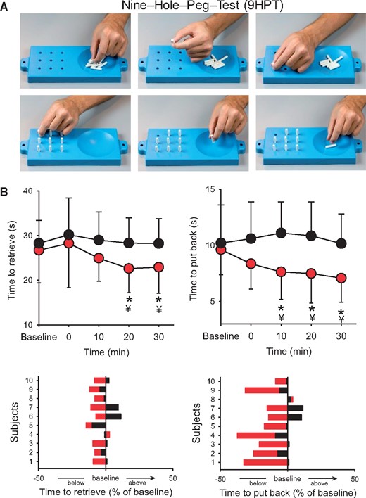 Nine-hole peg test. Manual dexterity was assessed by examining changes in the speed to complete the nine-hole peg test before (baseline) and after (0, 10, 20, and 30 min) the I-wave protocol in participants with SCI. (A) Individual images showing the steps to complete the nine-hole peg test. Note that the top row shows the part of the test where each pin is lifted by a precision grip between the index and thumb and deposited into the reservoir located on the side, while the bottom row shows that each pin is pick up and repositioned back into each hole by a precision grip between the index and thumb (Subject 7 on Table 1). (B) Graph shows group (upper) and individual (lower) data in a participant with SCI (n = 10). The abscissa shows the time of measurements, and the ordinate shows the time to complete the test (in ms) before and after the I-wave (red circles) and control (black circles) protocol. Time to retrieve and replace the pins (expressed as a percentage of baseline) are shown for individual subjects after the I-wave (red bars) and control (black bars) protocol. Error bars indicate SDs. *P < 0.05, comparison between protocols; ¥P < 0.05, comparison with baseline.