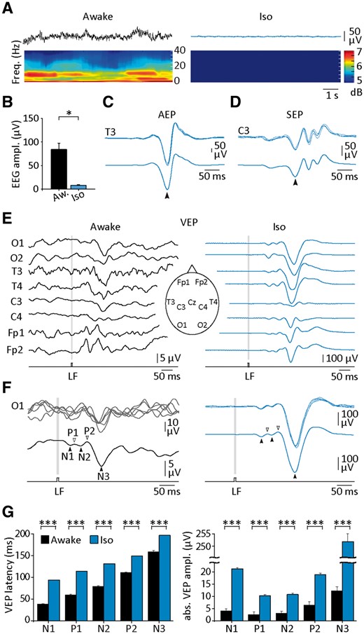 Comparison of sensory-evoked potentials recorded in human subjects during waking and isoelectric EEG. (A) Background EEG activity in a healthy awake subject (left) and in a patient with intractable status epilepticus who received high doses of sodium thiopental (right). The corresponding time-frequency maps, obtained using the Morlet wavelet, are depicted below the recordings. (B) Histogram of EEG amplitudes measured from awake subjects (Aw, n = 5) and patients with drug-induced isoelectric EEG (Iso, n = 4). (C and D) Representative AEPs (C) and SEPs (D) recorded from a patient with an isoelectric EEG. Five individual responses (top recordings) are superimposed above the corresponding averaged (n = 30 successive trials) potentials (bottom). The arrowheads indicate the maximum amplitude of the responses. (E and F) VEPs in response to repeated light flashes (LF) (8-ms duration) recorded using scalp EEG electrodes (eight electrodes positioned as illustrated in the inset in E) in a waking subject (E, Awake) and in a patient in isoelectric state (E, isoelectric). Here and in the following figures, the stimulation period is indicated by the grey boxes. (F) Superimposition of individual VEPs (top traces, n = 5) recorded from the O1 electrode in the waking and comatose subject and corresponding averaged responses (bottom traces, n = 50 successive trials). The arrowheads indicate the different components typically composing the flash-induced VEP. (G) Summary data of the mean latency and absolute amplitude of the different VEP components computed from the two subjects illustrated in E and F. *P < 0.05; ***P < 0.001.