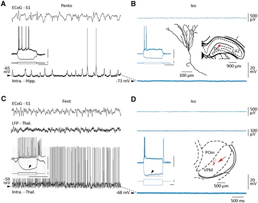 Intracellular correlates of isoelectric ECoG in subcortical structures. (A–D) Simultaneous recordings of S1 ECoG (top recordings) and corresponding intracellular activity from a dentate gyrus (A and B) and a thalamic (C and D) neuron, during active control period (A, pentobarbital; C, fentanyl) and after suppression of spontaneous cortical activity (B and D, isoelectric). Local field potentials (LFP - Thal) were also captured in the somatosensory thalamic nuclei (C, middle recording). The voltage responses of the two neurons to depolarizing and hyperpolarizing current pulses in control (black recordings) and during ECoG suppression (blue recordings) are shown in insets (scale bars = 30 mV, 1 nA, 100 ms). Note the hyperpolarization-activated depolarizing sag (arrowhead) in the thalamic neuron. A reconstruction of the somato-dendritic field of the neurobiotin-loaded dendate gyrus (DG) neuron and the location of the recorded neurons in the DG and in the ventroposteromedial (VPM) thalamic nucleus (B, red dot; D, red arrow) are also illustrated. POm = posteromedial thalamus.