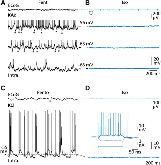 Lack of overwhelming Cl−-dependent inputs in neocortical neurons during isoelectric state. (A and B) Combined ECoG and intracellular recordings (using KAc electrode) from S1, in control (fentanyl, A) and during suspension of cortical activity (isoelectric, B). Intracellular records were made from a pyramidal cell, at rest in the two conditions (black arrowheads) and during DC displacement of Vm, as indicated by the white arrowheads. During active periods, presumed hyperpolarizing IPSPs (asterisks) could be detected in absence of holding current and during DC depolarization. DC current in control: +0.05 (top trace) and −0.2 nA (bottom trace). DC current in isoelectric condition: +0.2 (middle trace) and +0.4 nA (top trace). (C and D) S1 ECoG monitoring and simultaneous intracellular activity of a pyramidal cortical neuron recorded using an intracellular pipette filled with KCl in control (pentobarbital, C) and after induction of the isoelectric state (isoelectric, D). Note the absence of depolarizing Cl−-dependent IPSPs during ECoG suppression. The voltage responses of the cortical neuron to depolarizing and hyperpolarizing current pulses are shown in the inset. Heart symbols indicate the cardiac artefacts visible in the ECoG signal.
