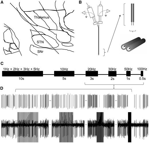 Experimental recording location, stimulation protocol, and an example of a neuronal recording in human STN. (A) A representative microelectrode track of the STN and SNr, in which recordings and experimental protocols were executed. (B) Our custom dual-microelectrode recording assembly with ∼600 µm mediolateral spacing. Upon locating a well isolated spike on one electrode, the adjacent microelectrode was used to deliver stimulation. (C) Timeline of the stimulation protocol for frequency-dependent studies of neuronal firing, silent period, and short-term plasticity. All stimulation protocols used 100 µA and 0.3 ms biphasic pulse widths. Note that only one block of 10 s is shown for 1, 2, 3, and 5 Hz stimulation trains. In fact, each of these stimulation trains was delivered for 10 s. Intervals between stimulation trains were ∼5–10 s. (D) A template matched spike (top trace) from a raw recording (bottom trace) obtained in the STN of showing inhibition of neuronal firing during 20, 30, 50, and 100 Hz stimulation trains, and a prolonged silent period after 100 Hz.