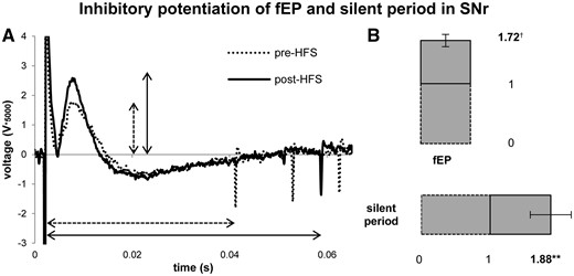 HFS-induced inhibitory synaptic plasticity at SNr recording sites. Stimulation with 1 Hz (100 µA, 0.3 ms, 10 s) test pulses revealed an inhibitory fEP. (A) A raw trace (5000× gain) of the fEP peak amplitude and transient inhibition of neuronal firing during a single pre-, and a single post-HFS test pulse. (B) After HFS (100 Hz, 100 µA, 0.3 ms, 10 s), both the fEP and the transient silent period were increased significantly. The fEP increased by an average factor of 1.72 (P < 0.001), while the silent period increased by factor of 1.88 (P < 0.01) from baseline. **P < 0.01, †P < 0.001.