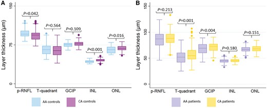 Comparisons of retinal thickness measures at baseline (in µm) in African Americans versus Caucasian Americans. (A) Comparison in healthy controls. (B) Comparison in multiple sclerosis patients. The corresponding P-values are also displayed. AMT = average macular thickness. AA = African American; CA = Caucasian American.
