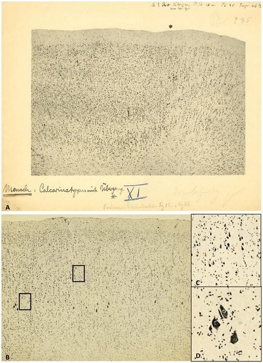 Micrographs of the human visual cortex with annotations by Brodmann. (A) Border (asterisk) between the primary (BA17, ‘Calcarinatypus’, right) and secondary (BA18, left) visual cortex of a human brain. Original micrograph with hand-written notes by K. Brodmann. (B) Brodmann’s area 4 (primary motor cortex) with Betz giant pyramidal cells (left). Note the excellent quality of the photographic technique in the magnified details (inserts C and D on the right; their positions are indicated as rectangles in the original micrograph). With permission of the C. & O. Vogt Archive, Institute of Brain Research, University Düsseldorf.