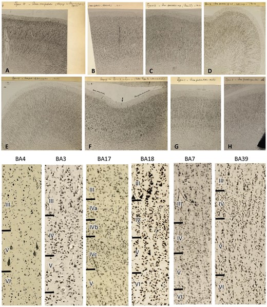 Original micrographs of human cortical areas by K. Brodmann (specimen M15). Transcriptions of Brodmann’s hand writing: (A) Area occipitalis BA18, secondary visual cortex at the transition to BA17. (B) Praeoccipitalis BA19 (higher visual cortex). (C) Area parietalis sup. (precuneus ant) BA7. (D) Area parietalis inf. ant = supramarg BA40, inferior parietal cortex. (E) Area pariet. post. inf = angularis BA39, temporo-occipital cortex. (F) Transition from BA4 to BA3, (primary motor to primary somatosensory cortex). (G) Area postcentralis oralis BA3, primary somatosensory cortex. (H) Area frontalis agranularis BA6, premotor cortex. Bottom: Higher magnifications of the original micrographs (A–H) demonstrate the larger (or at least equally large) pyramidal cells in layer III compared with those cells in layer V. This cytoarchitectonic feature is called ‘externopyramidization’ and typical for higher unimodal (BA18 as an example in the visual system) and multimodal (examples BA7 and BA39) areas. In contrast, the primary motor (BA4), somatosensory (BA3), and visual (BA17) cortices display larger pyramidal cells in layer V than III. Note the wider layer IV in primary sensory (BA3 and BA17) than multimodal (BA7 and BA39) areas, and the lack of a clearly visible layer IV in the primary motor area (BA4). With permission of the C. & O. Vogt Archive, Institute of Brain Research, University Düsseldorf.