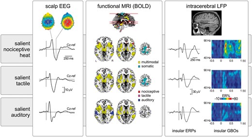Transient nociceptive stimuli causing pain. In this example heat laser pulses delivered to the right hand (scalp EEG and intracerebral LFP) or foot (functional MRI) elicit large-scale brain responses. In scalp EEG, the response is dominated by a large negative-positive wave maximal at the scalp vertex (electrode Cz), probably originating from bilateral operculo-insular regions, the cingulate cortex and, possibly, the contralateral primary somatosensory cortex. Responses in similar regions are also detected using functional MRI. Importantly, equally salient but non-painful and non-nociceptive tactile or auditory stimuli elicit very similar EEG and functional MRI responses, indicating that most of this activity is unspecific for pain or nociception and, instead, multimodal (Mouraux and Iannetti, 2009; Mouraux et al., 2011). Similarly, although the insula has been proposed to be strongly involved in pain perception, equally salient nociceptive and non-nociceptive stimuli trigger similar local field potentials (LFPs) recorded directly within the insula (Liberati et al., 2016). Nevertheless, other less prominent features of the sampled activity might be more selective for pain or nociception, as reflected by the selective increase of gamma-band oscillations (GBOs) when painful heat stimuli are presented (Liberati et al., 2018). BOLD = blood-oxygen level-dependent; ER% = event-related change in oscillation amplitude; ERP = event-related potential.